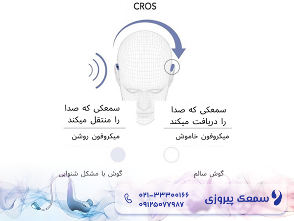 سمعک مناسب ناشنوایی یک طرفه